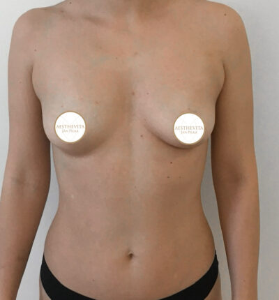 mia-femtech-010-pred