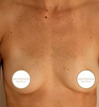 mia-femtech-012-pred