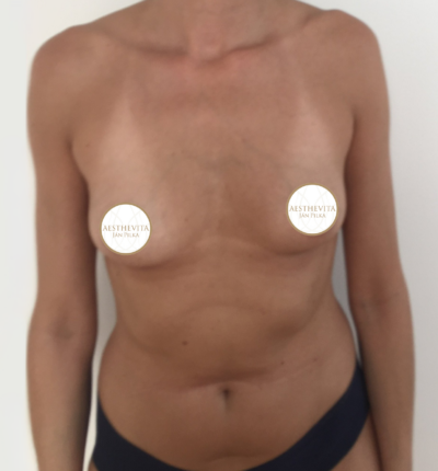 mia-femtech-013-pred