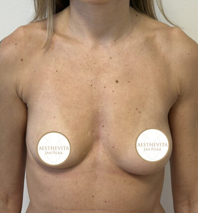 mia-femtech-020-pred