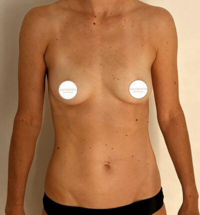 mia-femtech-025-pred