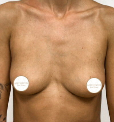 29a_mia_femtech_aesthevita_pilka-pred