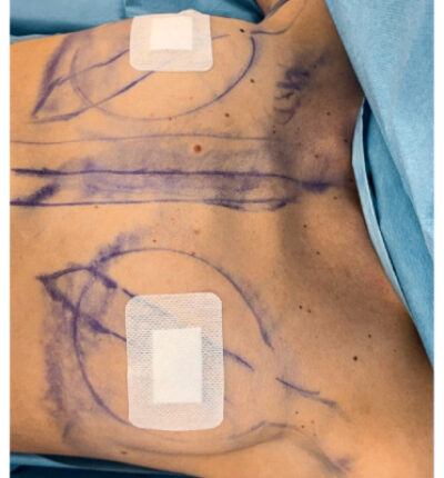 mia-femtech-028-pred-1