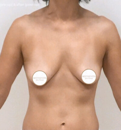 mia-femtech-033-pred