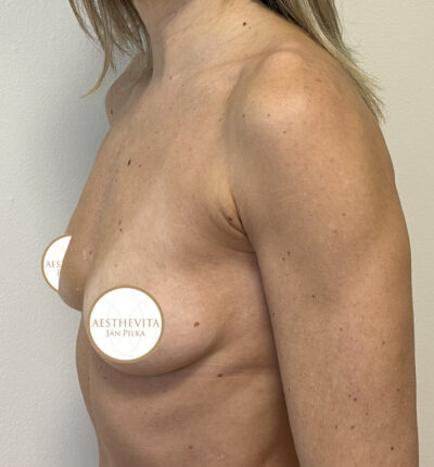 mia-femtech-043-pred