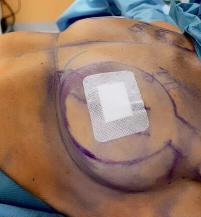 mia-femtech-046-pred