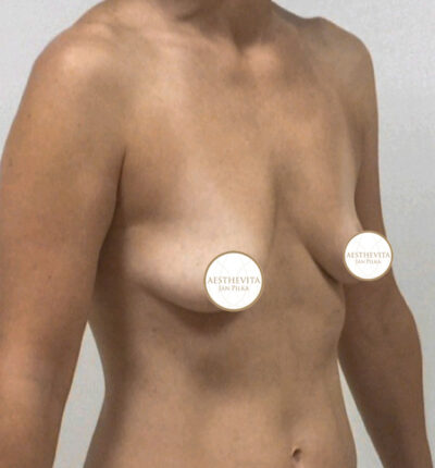 mia-femtech-053-pred