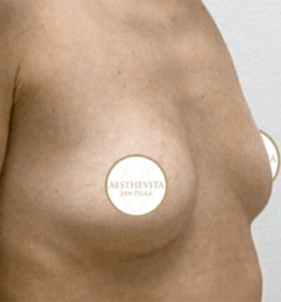 mia-femtech-059-pred