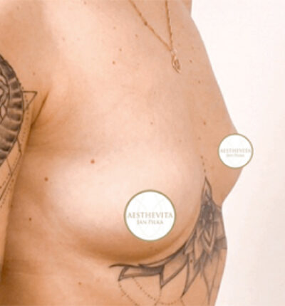 mia-femtech-062-pred